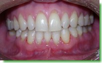 Casos Cl�nicos