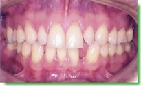 Casos Cl�nicos