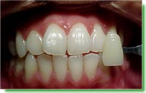Casos Cl�nicos