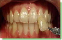 Casos Cl�nicos