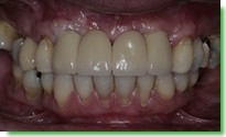 Casos Cl�nicos