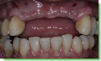 Casos Cl�nicos