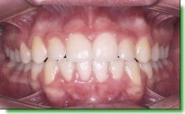 Casos Cl�nicos