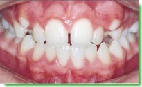 Casos Cl�nicos