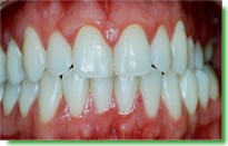 Casos Cl�nicos