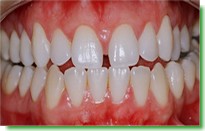 Casos Cl�nicos