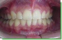 Casos Cl�nicos