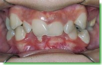 Casos Cl�nicos
