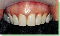 Casos Cl�nicos