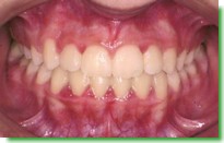 Casos Cl�nicos