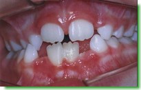 Casos Cl�nicos