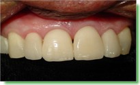 Casos Cl�nicos