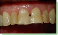 Casos Cl�nicos