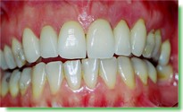 Casos Cl�nicos