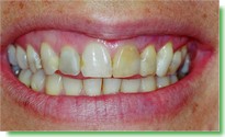 Casos Cl�nicos