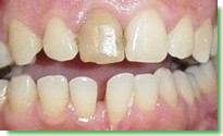 Casos Cl�nicos