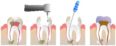 Endodontia