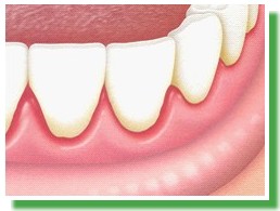 Periodontia