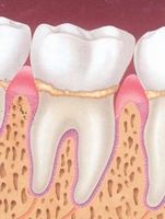 Periodontia