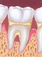 Periodontia